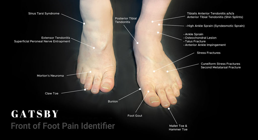 Foot Pain Chart: An In-Depth Guide to Identifying Foot Pain – GatsbyShoes