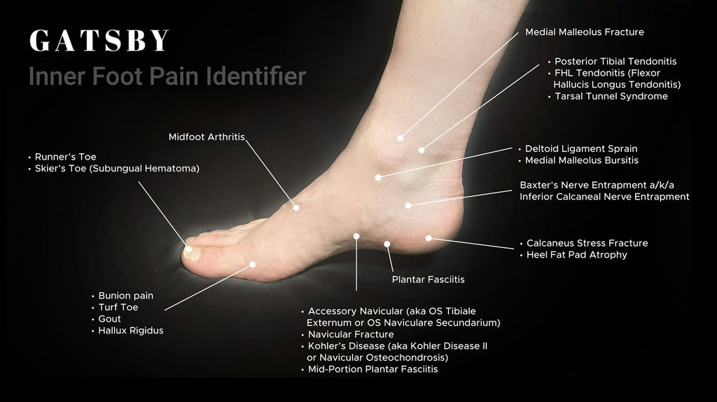 Foot Pain Chart: An In-Depth Guide to Identifying Foot Pain – GatsbyShoes