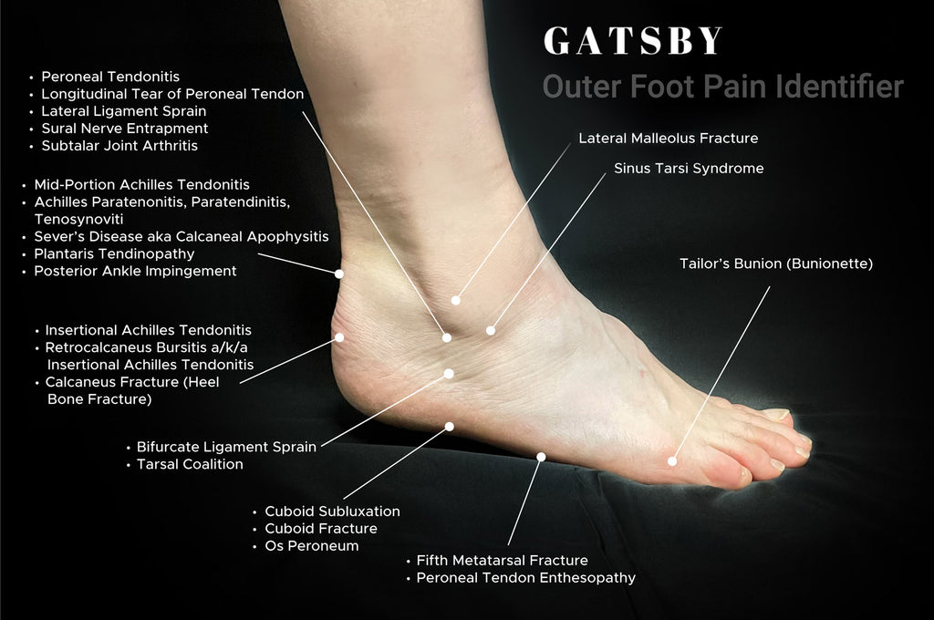 Foot Pain Chart: An In-Depth Guide to Identifying Foot Pain – GatsbyShoes