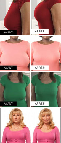 plus de soutien gorge avant apres