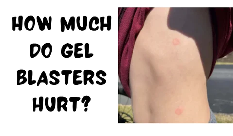 how much do gel blasater hurt