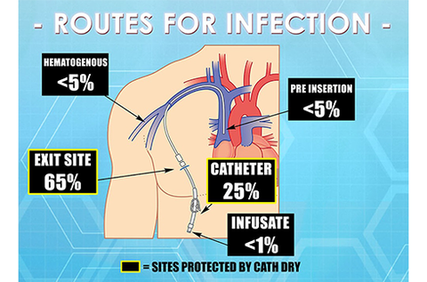 Cath Dry reduces infections