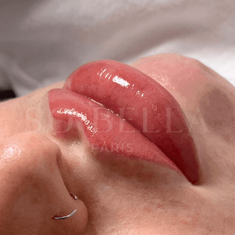 photo du rendu final d'un candy lips par sobella paris