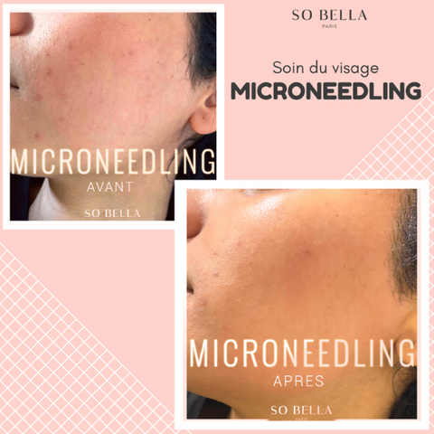Microblading before after 2