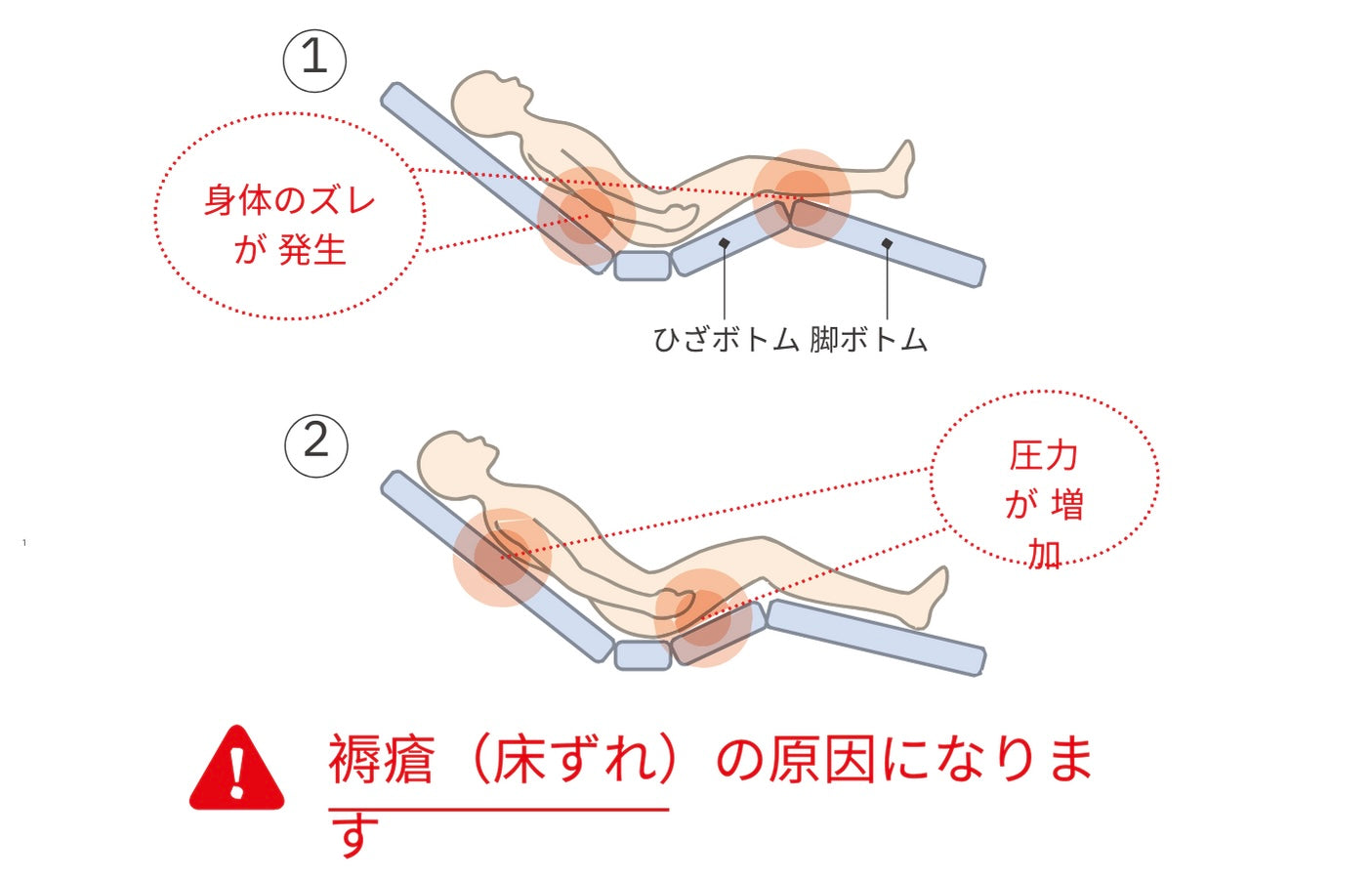 Miolet III 家庭護理床有效預防 壓瘡