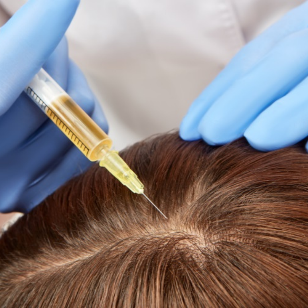 PRP FOR HAIR LOSS – Dr. Jennifer Levine