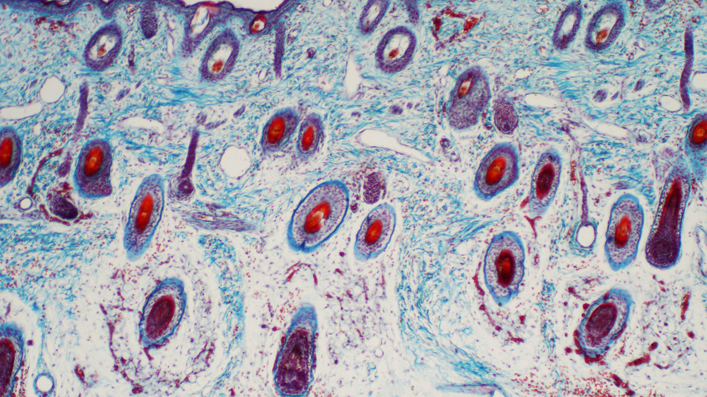 Microscope view of a cross section human skin tissue cells.