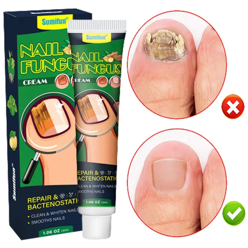 NatureLife SA - Nail Fix Antifungal Treatment is effective for even the  worst hand and toe nail fungal infections. Nail Fix penetrates through the  nail to reach the nail bed and then