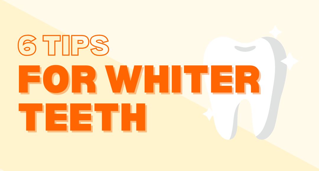 6 tips for whiter teeth