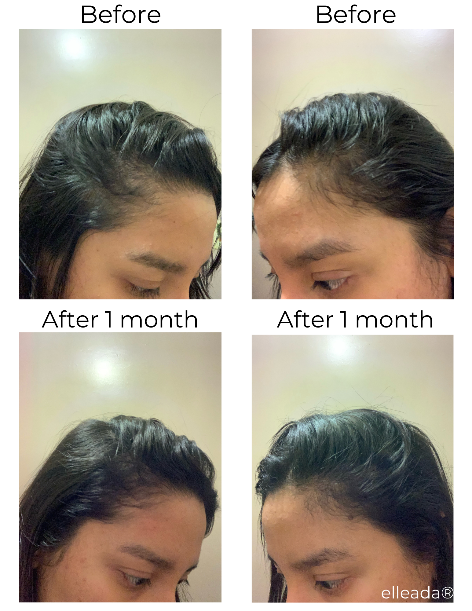 Elleada - All Natural Hair Repair & Growth Serum