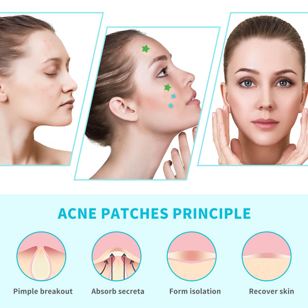 benefits of acne patch