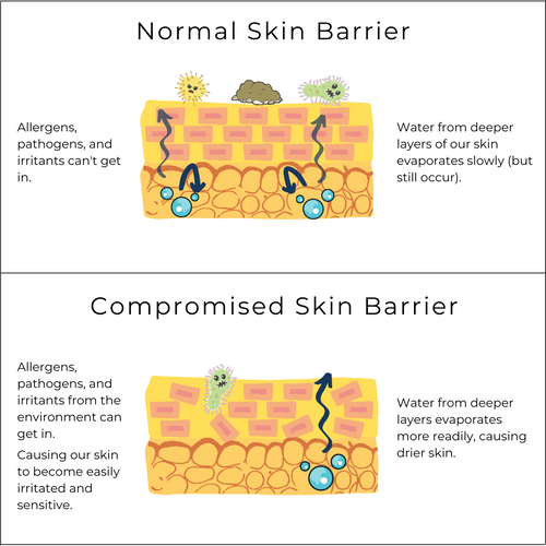 Illustrative comparison between normal and compromised skin barrier