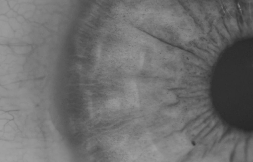 close up of an eye