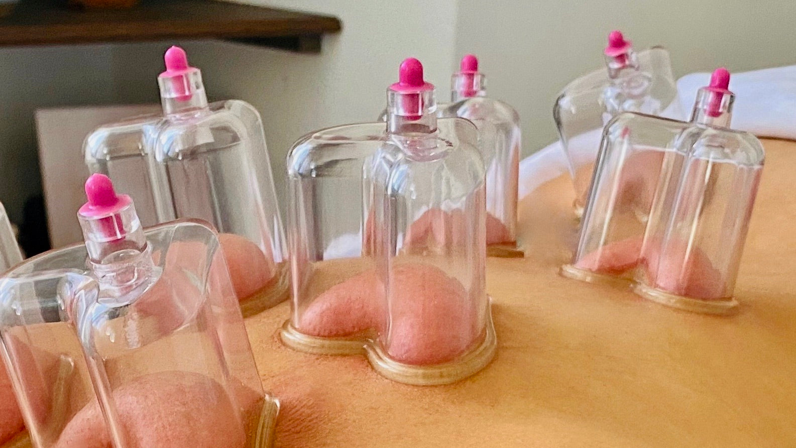 cupping