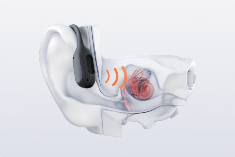 working principle of open ear bone conduction headphones shokz