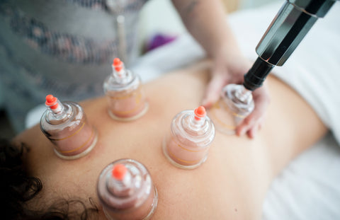 what is cupping therapy