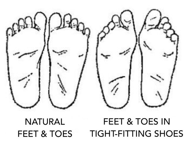 The shape of your foot in tight fitting shoes