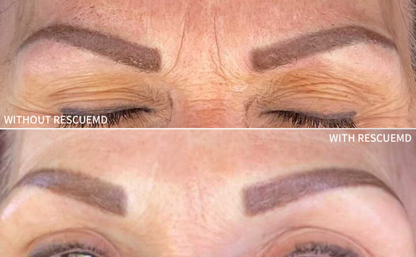 an image showing a woman's eye-brows post-micro-needling with and without the RescueMD, can see a clear difference 
