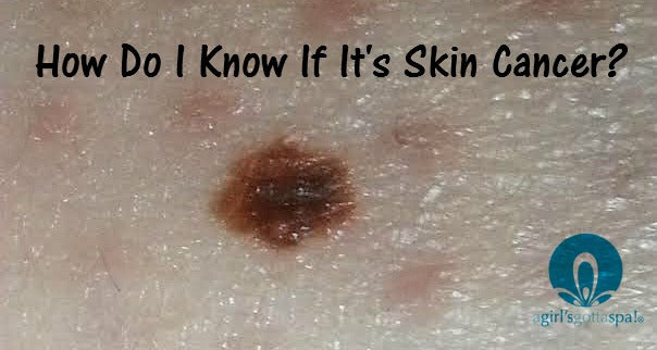 Beauty Marks, Moles or Skin Cancer? | A Girl's Gotta Spa!