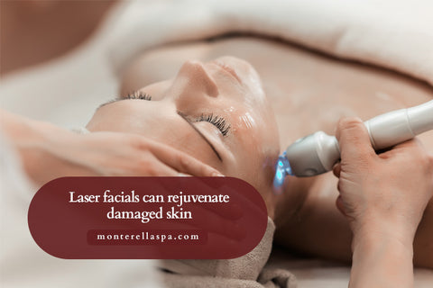 Laser facials can rejuvenate damaged skin