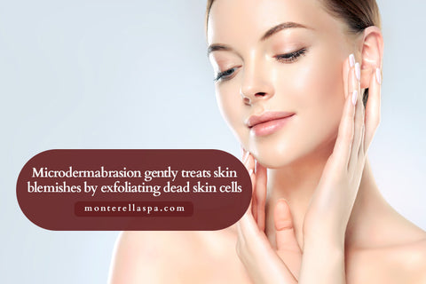 Microdermabrasion gently treats skin blemishes by exfoliating dead skin cells