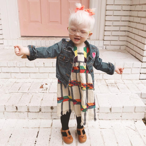 happy child with albinism