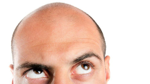 Cure for Male Pattern Baldness