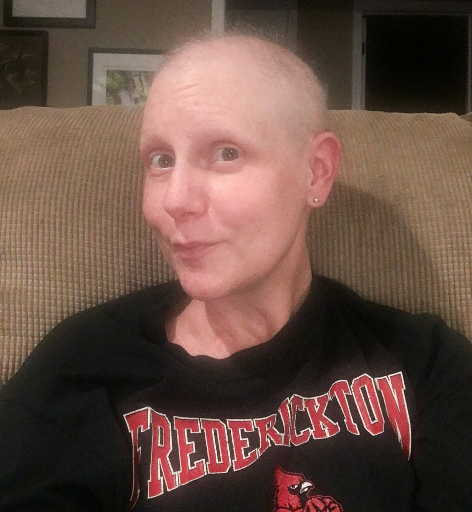 Chemo hair loss