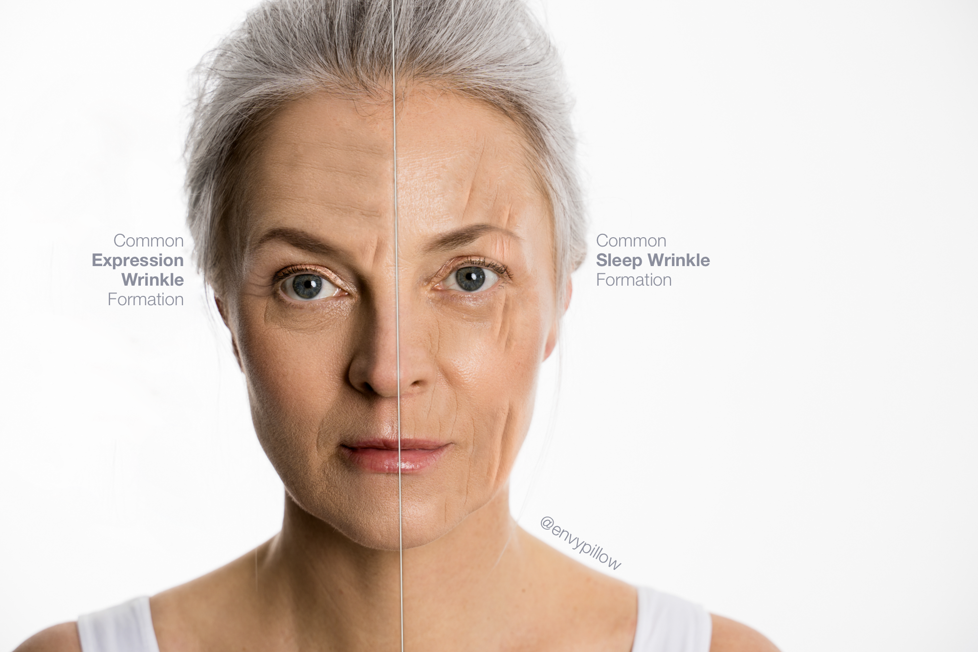 Aging Wrinkles or Sleep Wrinkles Cranston Side To Side