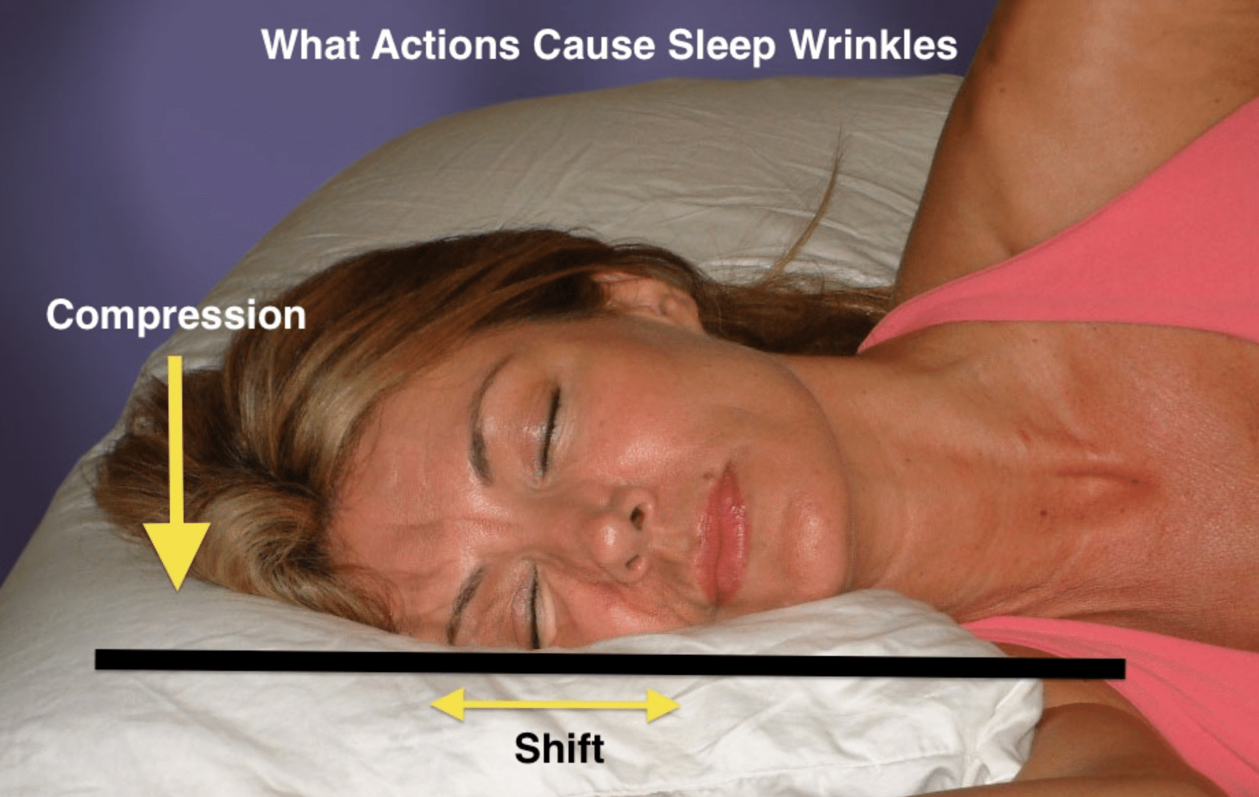 How sleep wrinkles are formed