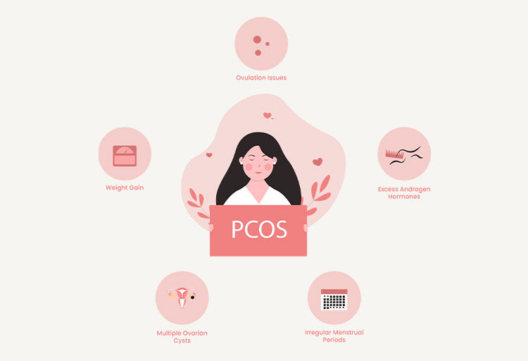 What are the most common symptoms of PCOS?