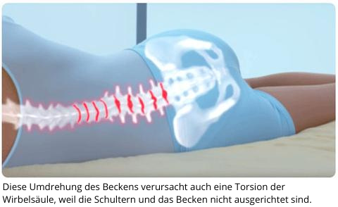 Leg Joy: Kissen zwischen den Beinen bei Rückenschmerzen - Bioloka