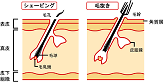 シェービングは肌の表面に出ている毛を処理するので、肌への刺激は比較的穏やか。古い角質も取れて、肌の色もきれいになるといわれています。