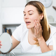 young woman suffering from acne on her cheek looking in the mirror