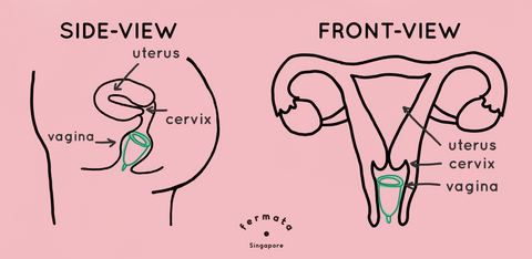 menstrual cup in cervix fermata