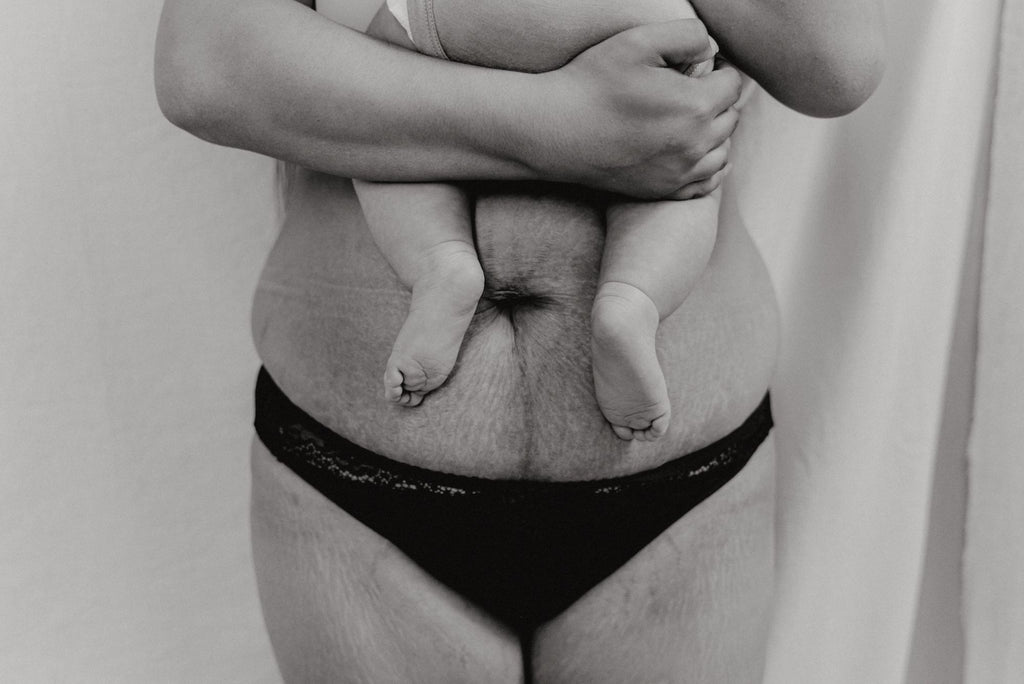 Hotmilk Lingerie celebrates the postpartum imperfection's of a mum body