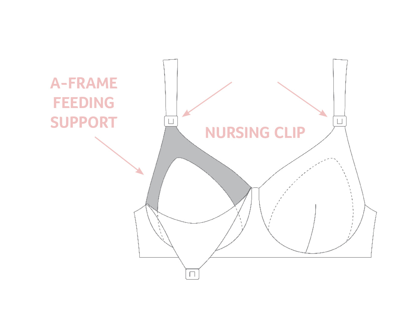 Internal bra' may help extend the benefits of your aesthetic