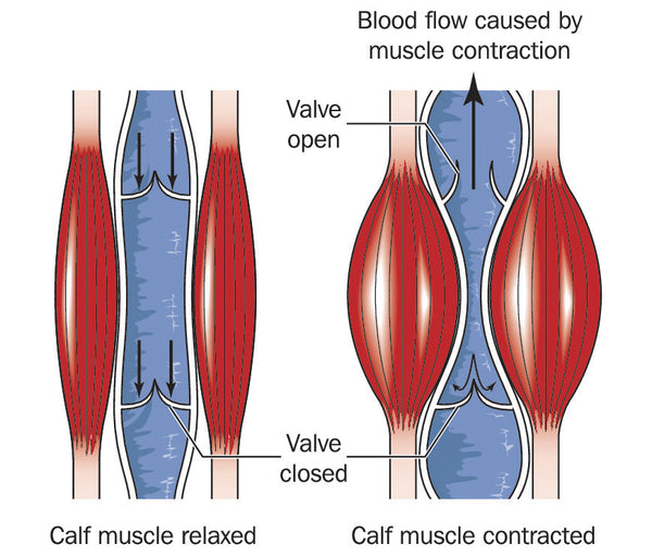 Varicose veins - how the calf muscle pump or peripheral heart works