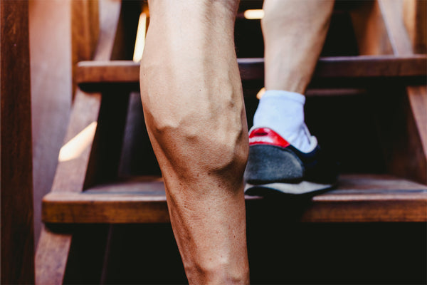 Varicose veins in men