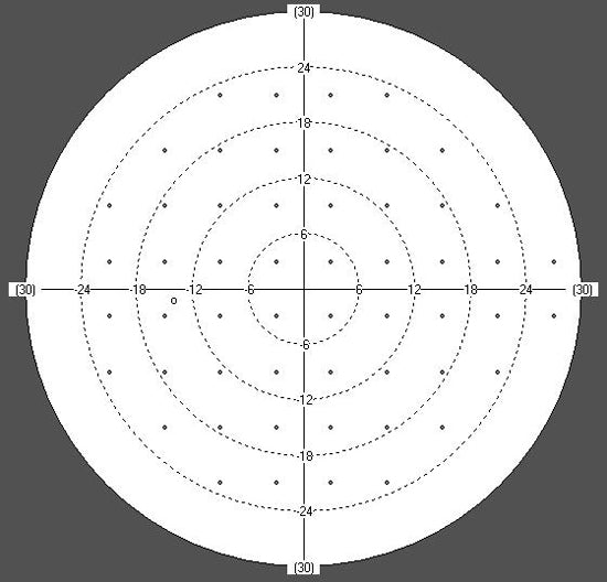 perimeter huvitz hvf-100