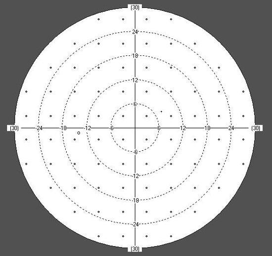 perimeter huvitz hvf-100