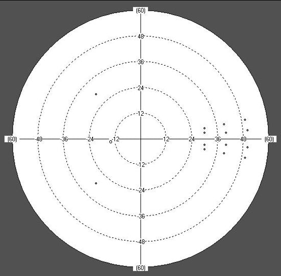 perimeter huvitz hvf-100