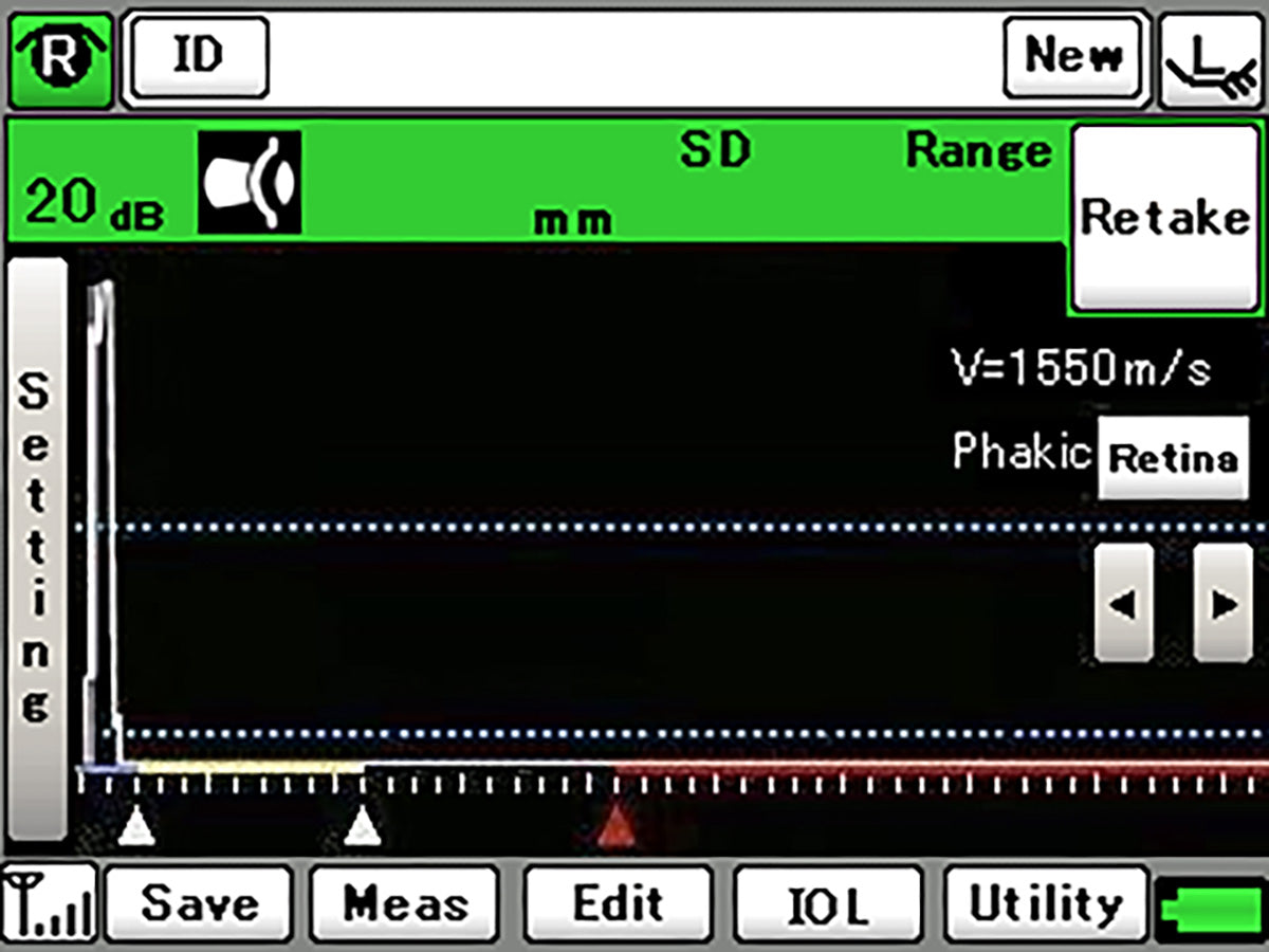 ultrasonido tomey - us ophthalmic