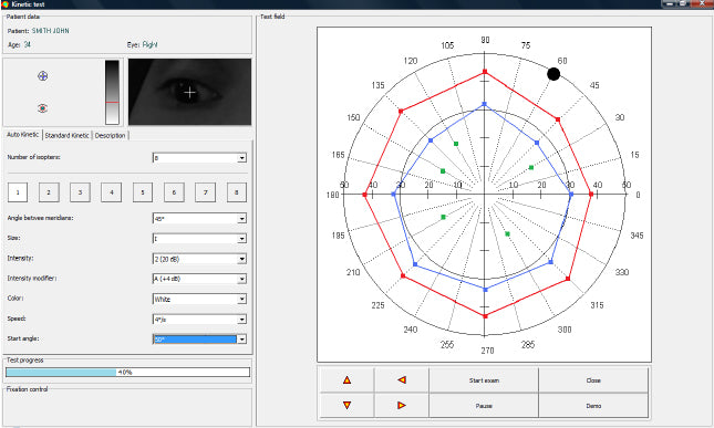 Automated Kinetic and Static Perimeter with Embedded PC with Mount with Monitor AP-300 frey - us ophthalmic