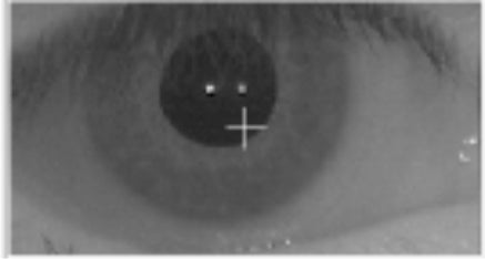 Automated Kinetic and Static Perimeter with Embedded PC with Mount with Monitor AP-300 frey - us ophthalmic