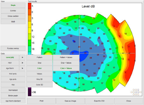 Automated Kinetic and Static Perimeter with Embedded PC with Mount with Monitor AP-300 frey - us ophthalmic