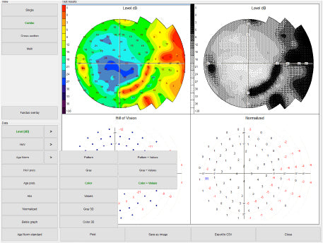 Automated Kinetic and Static Perimeter with Embedded PC with Mount with Monitor AP-300 frey - us ophthalmic