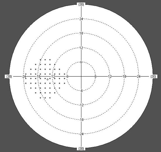 perimeter huvitz hvf-100