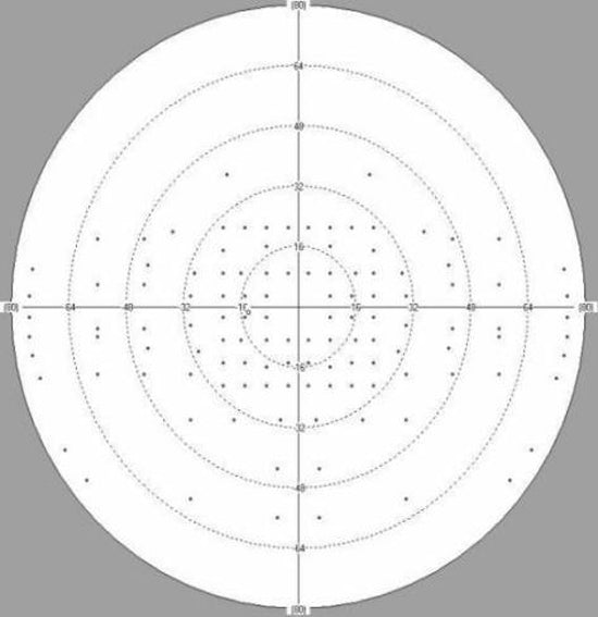 perimeter huvitz hvf-100