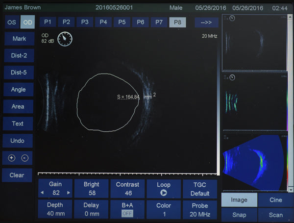 ultrasound eus-2600 ezer - us ophthalmic